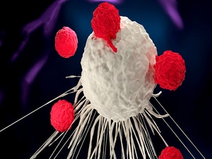 'Remarkable' Results With CAR T Cells Could Make Chemo Obsolete