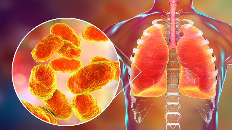 Methicillin-Resistant Staphylococcus aureus (MRSA) | Medscape