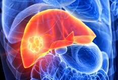 can simethicone cause liver damage