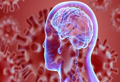 Influenza Clinical Presentation History Physical Examination