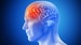 ACT Tenecteplase Trial to Change Clinical Practice in Stroke?