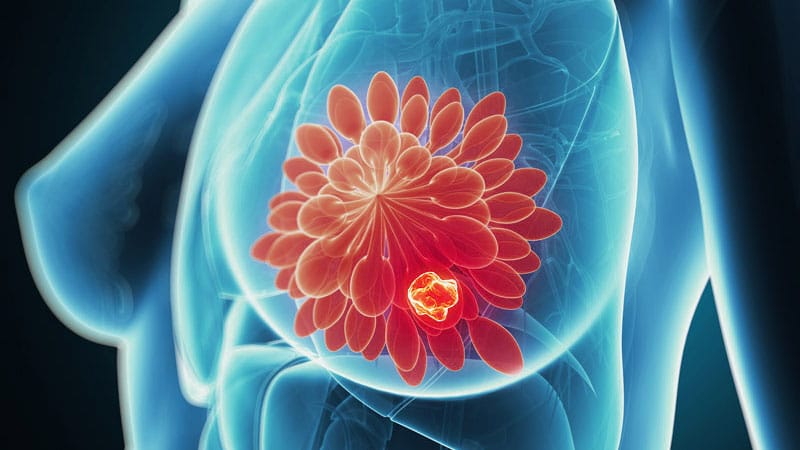 FDA Approves In-home Breast Cancer Treatment