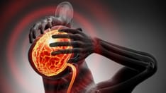 Higher Stroke Rate in COVID-19 vs Influenza