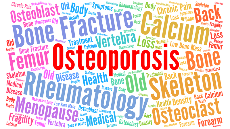 AFF With Bisphosphonates Highest in Asians, Study Confirms