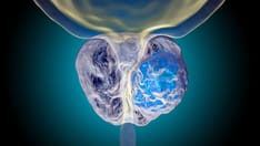 Enzalutamide Improves Metastasis-Free Survival, QoL in Prostate Cancer