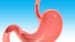 New First-Line Standard of Care for Esophageal Cancer?