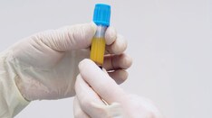 'P-Shot' for Erectile Dysfunction: Pricey and Without Proof