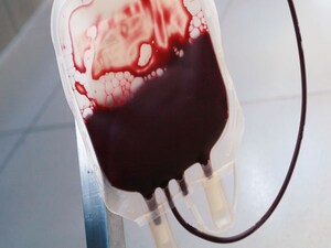 No Benefit From Tranexamic Acid Prophylaxis in Blood Cancers