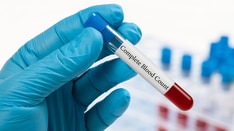 Lab Algorithm Cancels Same-Day Redundant Orders Automatically