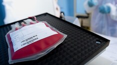 Red-Cell Donor's Sex Does Not Affect Transfusion Survival