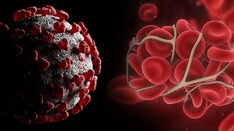 Full-Dose Anticoagulation Reduces Need for Life Support in COVID-19