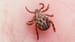 Not Much New in New Clinical Guidelines for Tick-Borne Illness