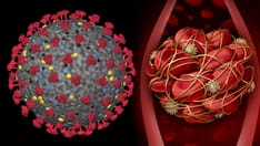 Blood Clot Risks 'Lower With COVID Vaccines Than From Infection'