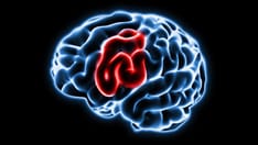 'Living Brain Implants' May Restore Stroke Mobility