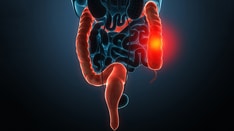 Early-Onset Colon Cancer Projected to Double by 2030