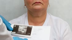 COVID-19 Can Cause Atypical Thyroid Inflammation