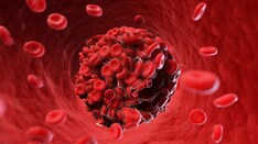 Warfarin Best for Thrombotic Antiphospholipid Syndrome?