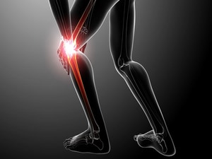 Which Comes First in Osteoarthritis: The Damage or the Pain?