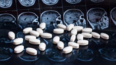 No Overall Statin Effect Seen on Dementia, Cognition in ASPREE Analysis