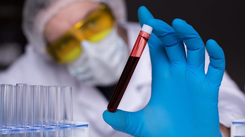 Assays May Guide SGLT2 Inhibitor Use in High CV-Risk Diabetes