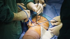 Study Eases Fears: Knee Surgery Surge Not Linked to Premature Intervention