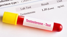 Testosterone Therapy for Hypogonadism With Diabetes?