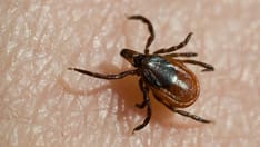Cases of Meat Allergy Linked to Tick Bites on the Rise: CDC