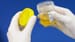 Simple Urine Test Could Improve Detection of Bladder Cancer