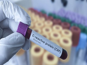 Normal CRP During RA Flares May Describe Unique Phenotype