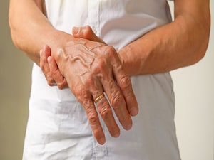 Methotrexate's First Evidence of Disease Modification in Pre-RA