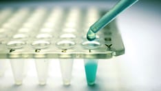 Stem Cell Transplant Seen as Major Type 1 Diabetes Advance