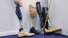 Amputees Lost in the COVID-19 Shuffle