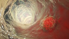 Rapid Review Quiz: Colorectal Cancer Recent Studies