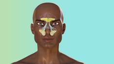 Clinical Data Affirms Dupilumab for Chronic Nasal Polyps 