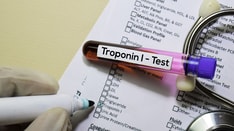 What Troponin Level Indicates Injury After Cardiac Surgery?
