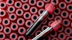 Trial Shows Utility of Small-Volume Blood Collection Tubes