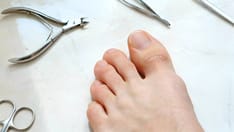 Clinical Clarity Grows About Toenail Disorder, Experts Report