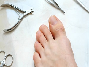 Clinical Clarity Grows About Toenail Disorder, Experts Report