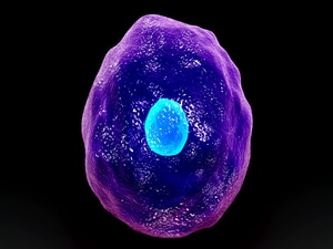 'Truly Impressive' Responses in Lymphoma With Novel Cell Therapy