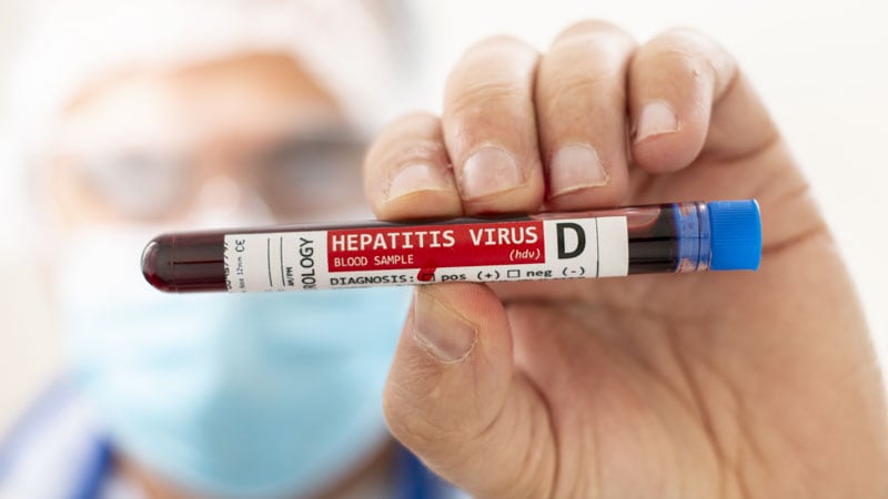 Hepatitis B | Medscape