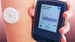 Is Continuous Glucose Monitoring for Everyone With Diabetes?