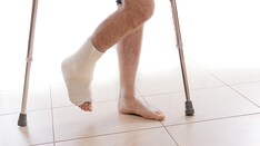 Young Adult Childhood Cancer Survivors Have Higher Fracture Risk