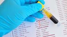 Low Bone Hormone Tied to Worse Cardiac Risk in Type 2 Diabetes