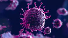 Most Long COVID Cases Started With Mild Symptoms: Study