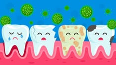 Poor Oral Hygiene After Stroke Can Alter Inflammation Risk
