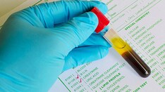 New European Kidney Function Equation: Improvement in Performance?