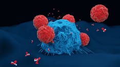 'Exciting': Off-the-Shelf T-cell Therapy Shows Promise
