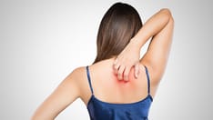 Difelikefalin Helps Upper Back Itch, but With Side Effects