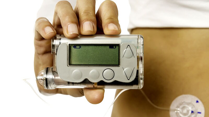 Insulin Therapy | Medscape