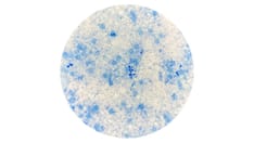 Cases of Potentially Deadly Fungus Jump 200%: CDC